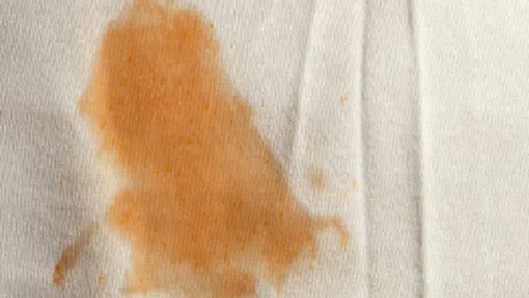 El truco viral que muestra cómo sacar las manchas secas de aceite de la ropa